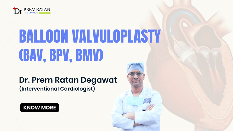 Balloon Valvuloplasty - (BAV, BPV, BMV)