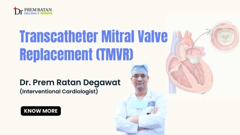 Transcatheter Mitral Valve Replacement (TMVR) in Jaipur, Rajasthan