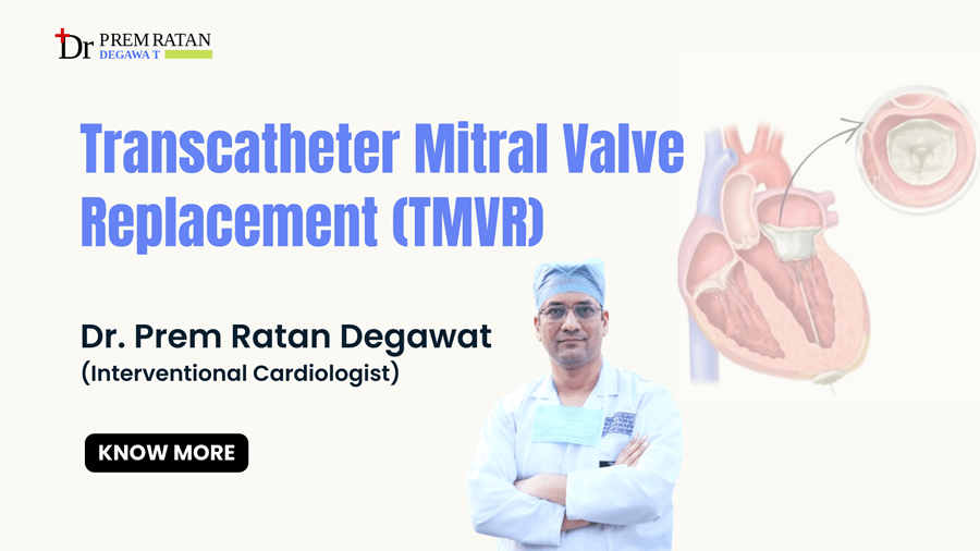 Transcatheter Mitral Valve Replacement (TMVR) in Jaipur rajasthan