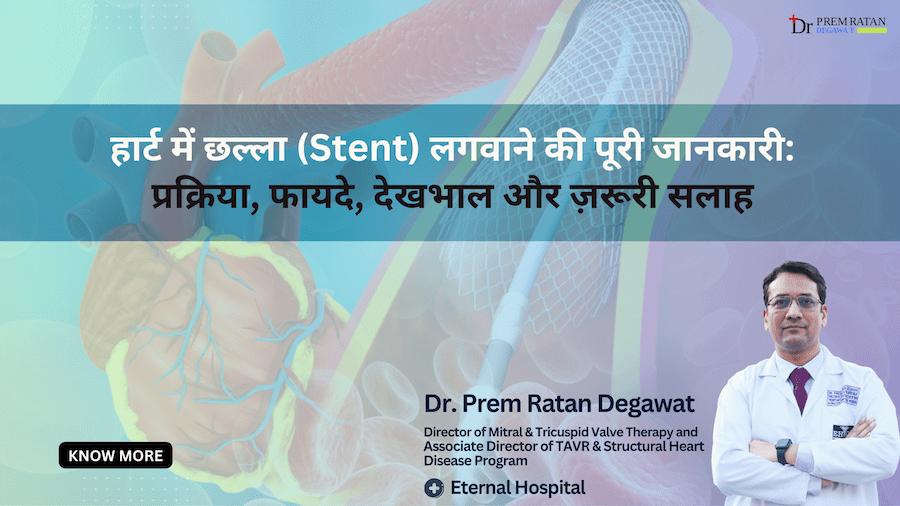 heart-challa-stent-placement-in-jaipur