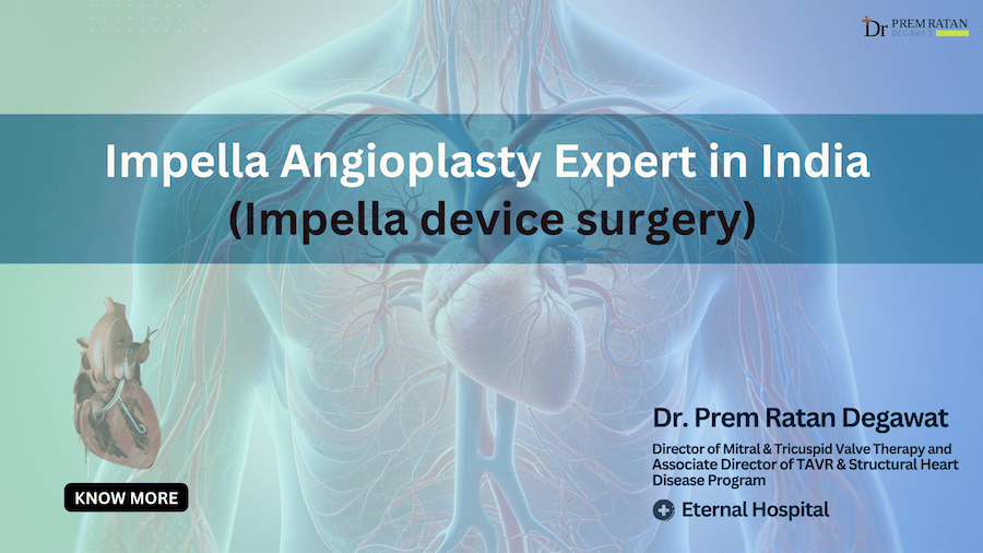 impella angioplasty expert