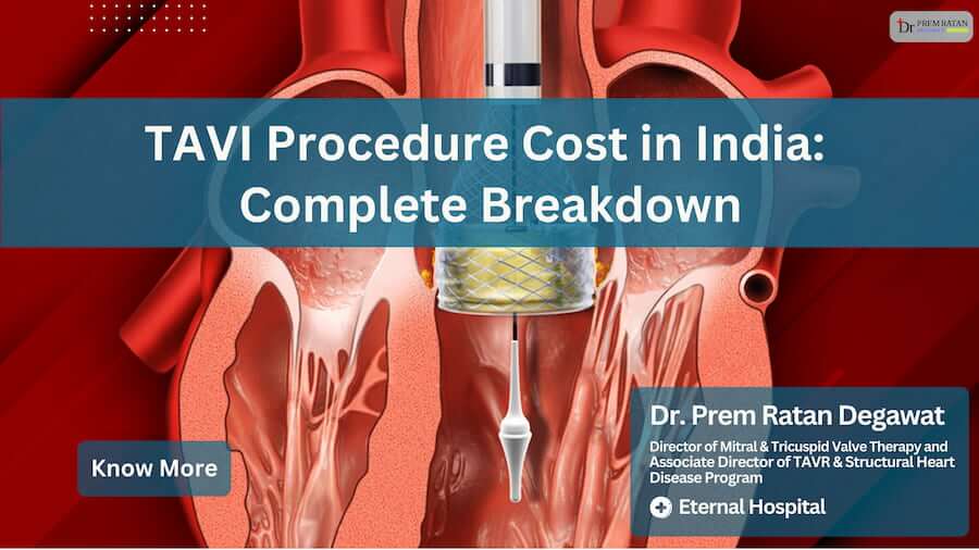 TAVI Procedure Cost in India