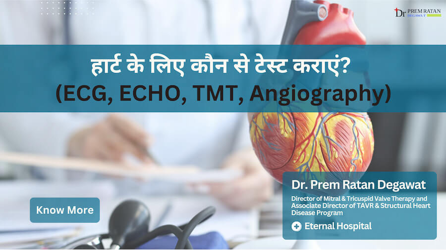 हार्ट के लिए कौन से टेस्ट कराएं