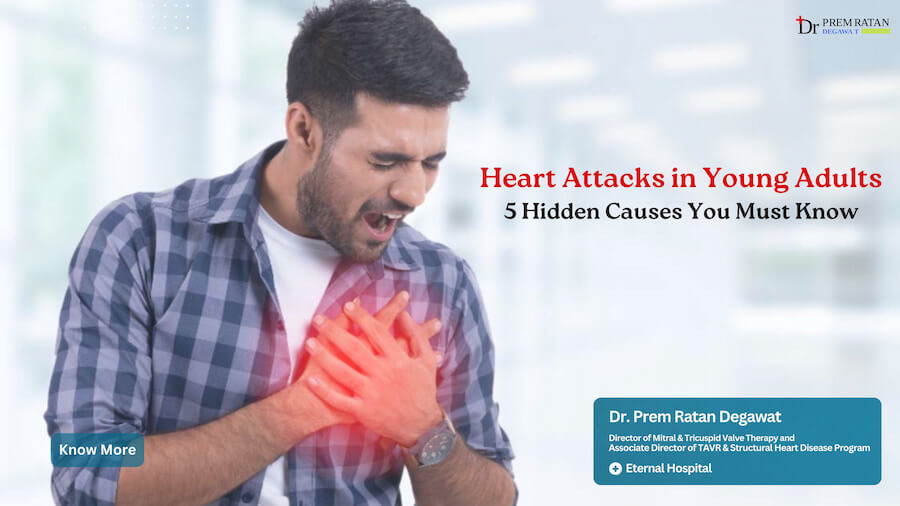Heart Attacks in Young Adults