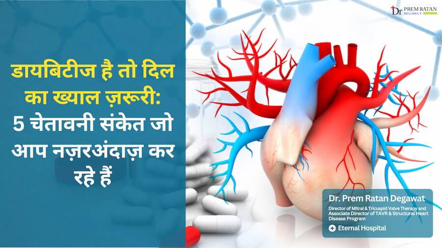 Diabetes and Cardiovascular Disease