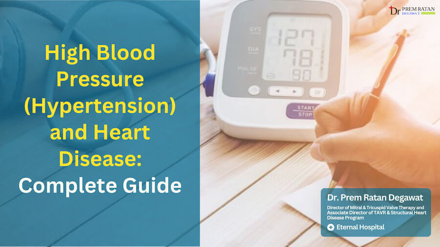 High Blood Pressure (Hypertension) and Heart Disease