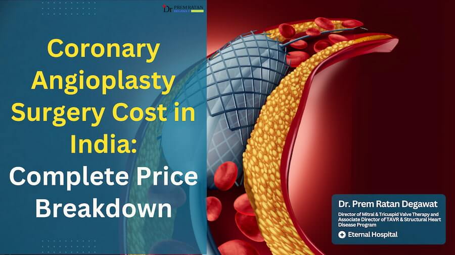 Angioplasty Cost in India