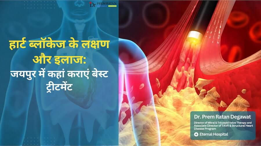 हार्ट ब्लॉकेज के लक्षण और इलाज