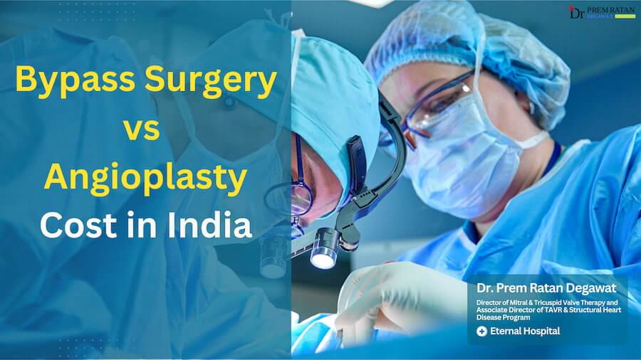 Bypass Surgery vs Angioplasty Cost in India