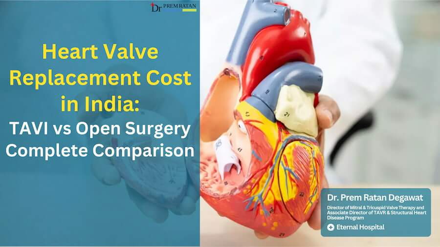 Heart Valve Replacement Cost in India