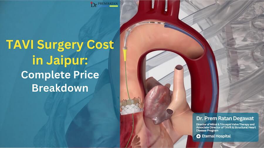TAVI Surgery Cost in Jaipur