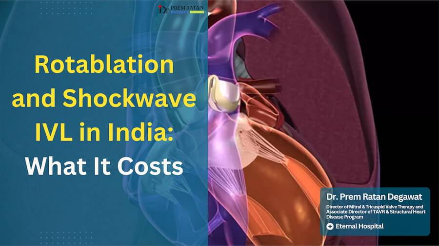 Rotablation and Shockwave IVL in India: When Normal Angioplasty Cannot Work and What It Costs