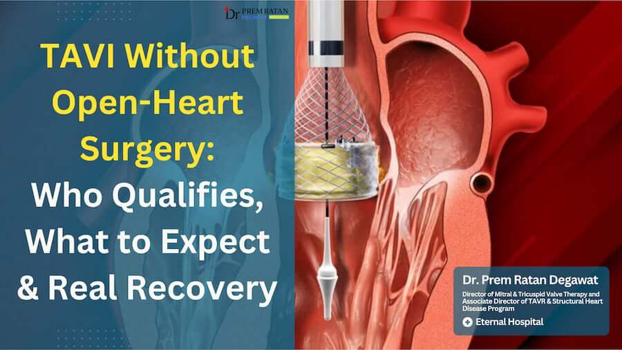 TAVI Without Open-Heart Surgery