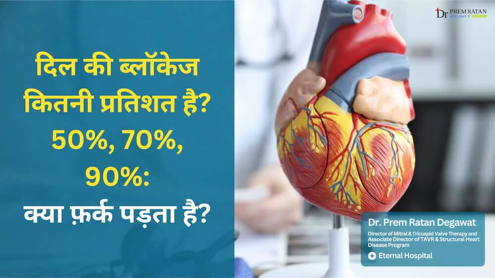 dil-ki-blockage-50-70-90-percent (1)