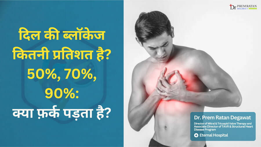 दिल की ब्लॉकेज कितनी प्रतिशत है 50%, 70%, 90%