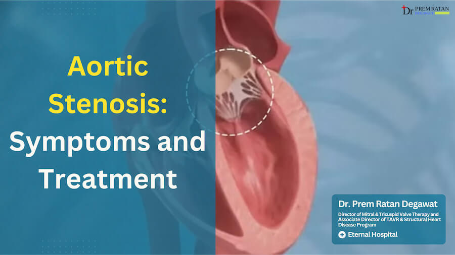Aortic Stenosis Symptoms and Treatment