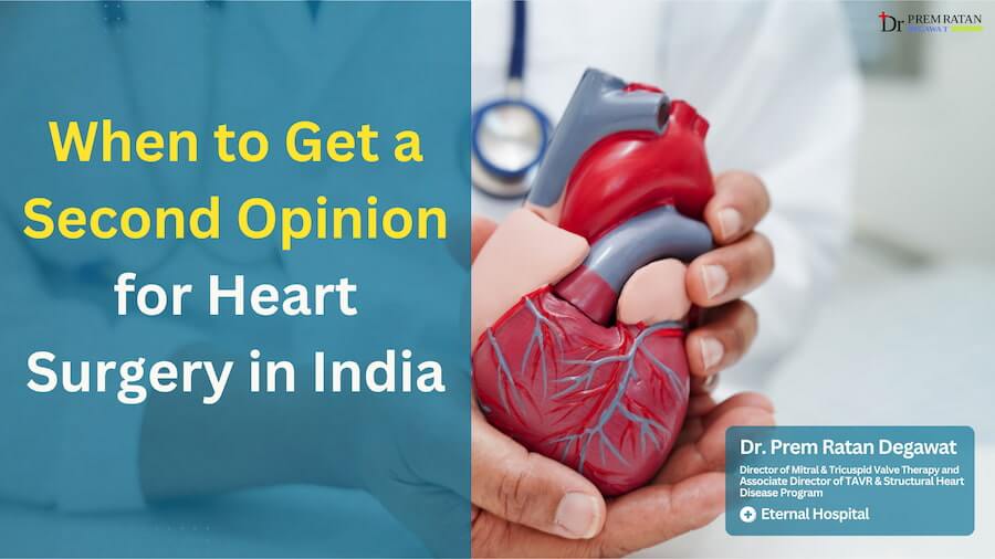 When to Get a Second Opinion for Heart Surgery in India