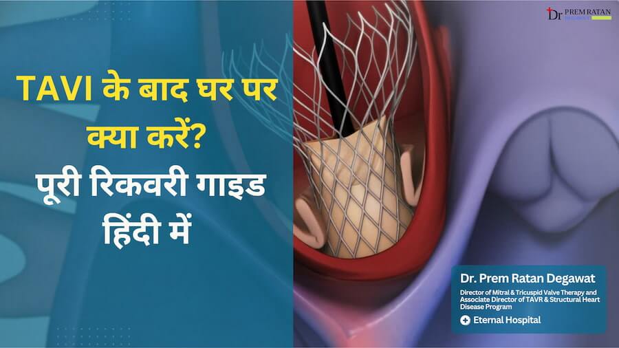 TAVI ke Baad Ghar Par Kya Karein Poori Recovery Guide Hindi Mein