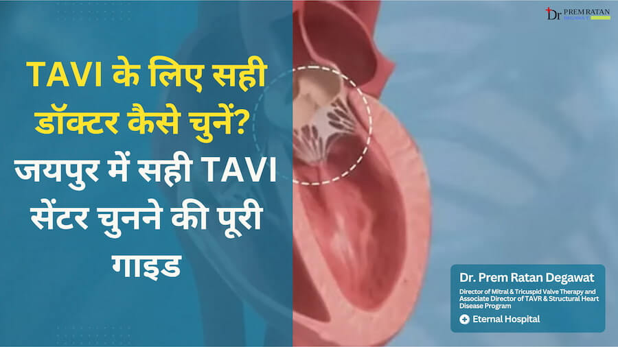 TAVI ke Liye Sahi Doctor Kaise Chunein