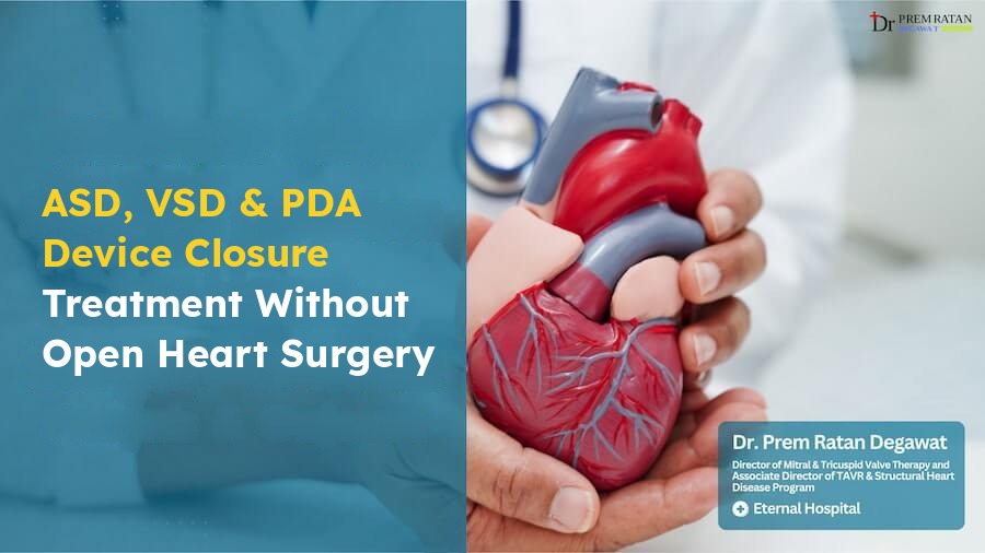 ASD, VSD and PDA device closure in Jaipur without open heart surgery, Dr. Prem Ratan Degawat, Eternal Hospital