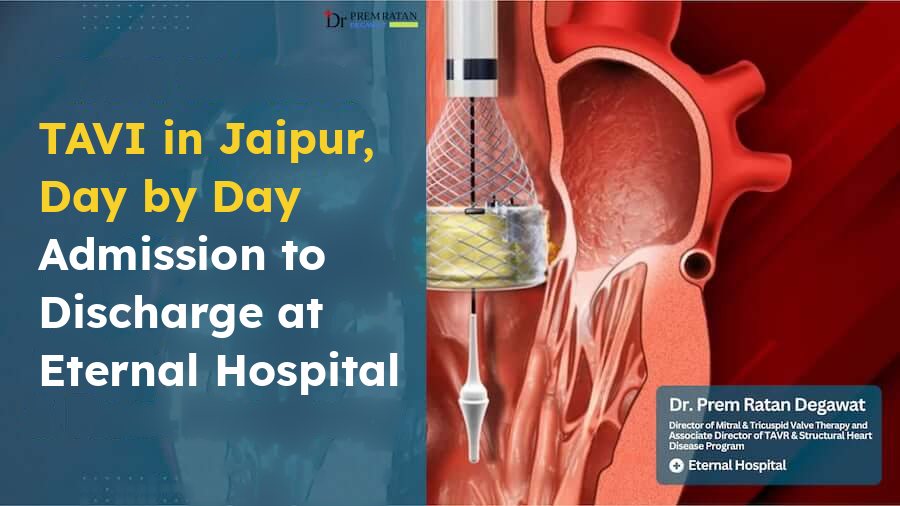 TAVI in Jaipur day by day, admission to discharge at Eternal Hospital, Dr. Prem Ratan Degawat