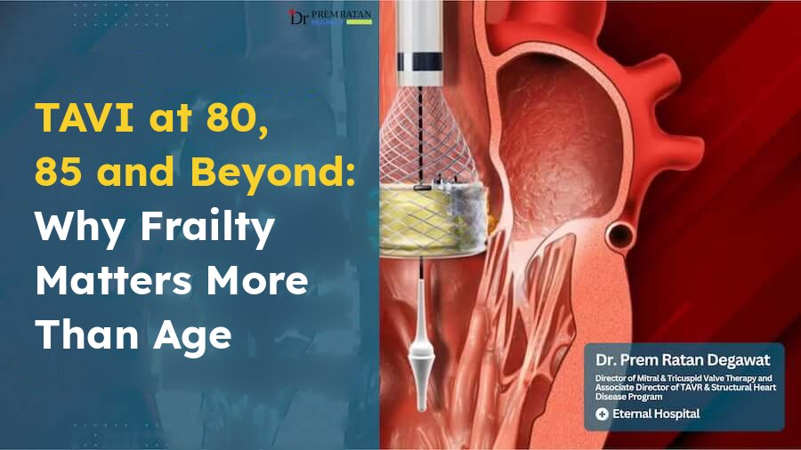 TAVI for patients over 80, with an illustration of a catheter-delivered heart valve.