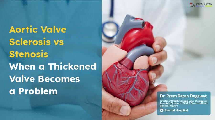 Aortic valve sclerosis compared with aortic stenosis, with a model of the human heart held in two hands.