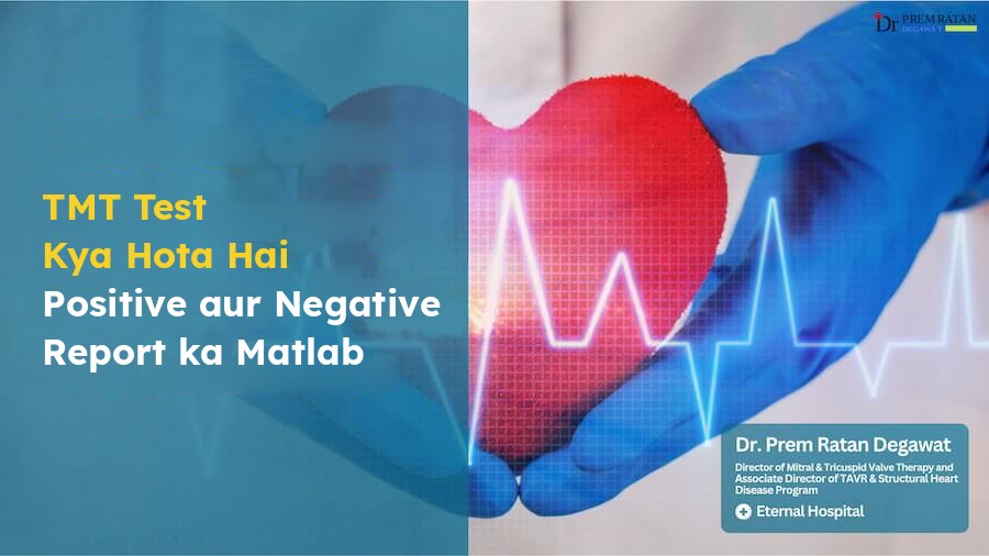 TMT test kya hota hai, treadmill par heart ki jaanch aur positive negative report ka matlab.